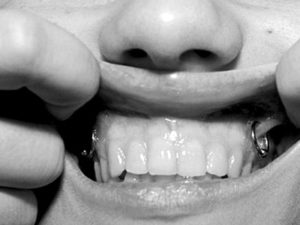 vampire piercing